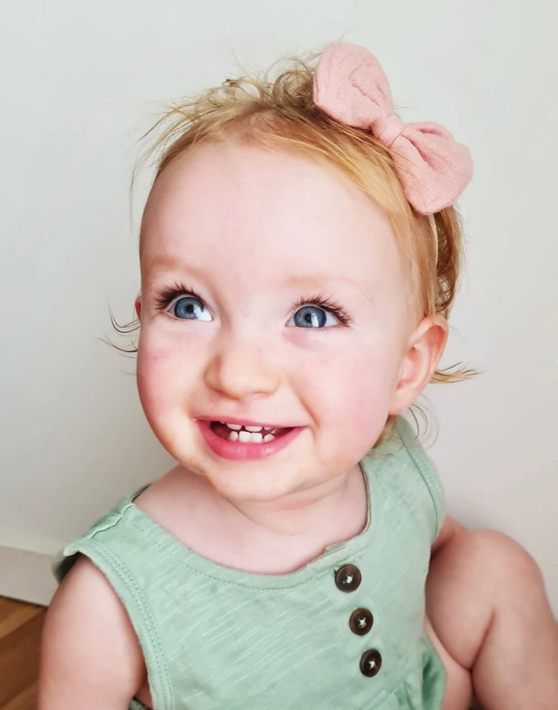 Over the Dandelions Bow Headbands